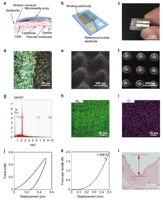 北京大学崔悦课题组《Microsystems & Nanoengineering》：3D打印微针生物传感器用于糖尿病的持续监测